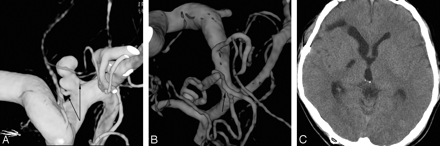 Fig 2.