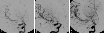 Fig 2.