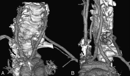Fig 1.