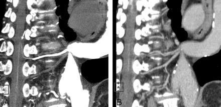 Fig 2.
