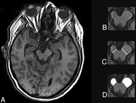 Fig 1.