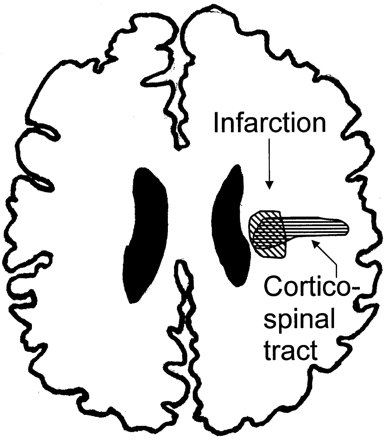 Fig 2.