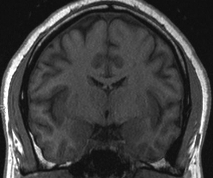 Fig 2.