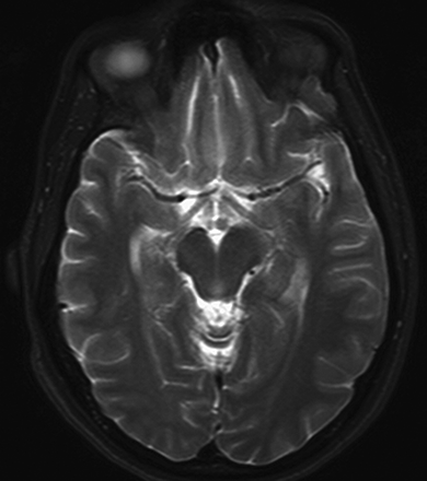 Fig 3.