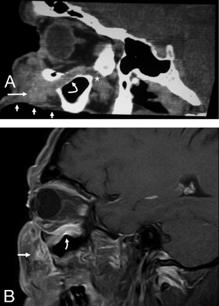 Fig 1.