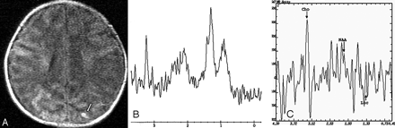 Fig 1.