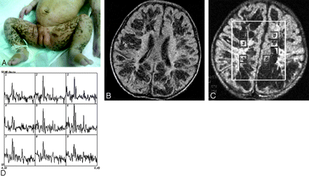 Fig 2.