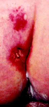 Fig 1.
