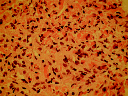 Fig 4.