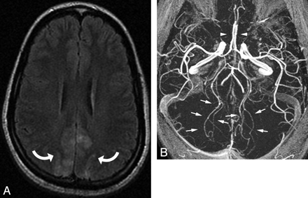 Fig 5.