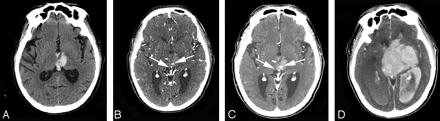 Fig 2.