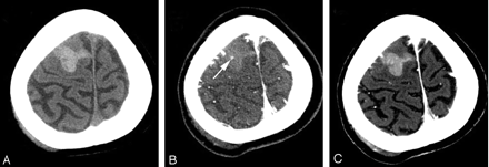 Fig 4.