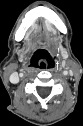 Fig 6.