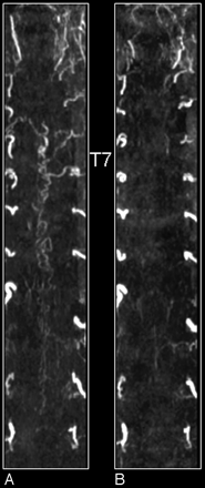 Fig 10.
