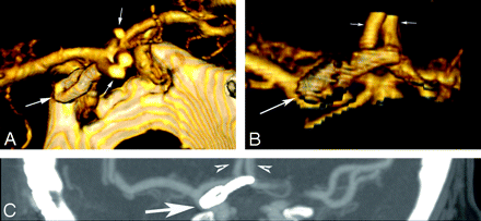 Fig 3.