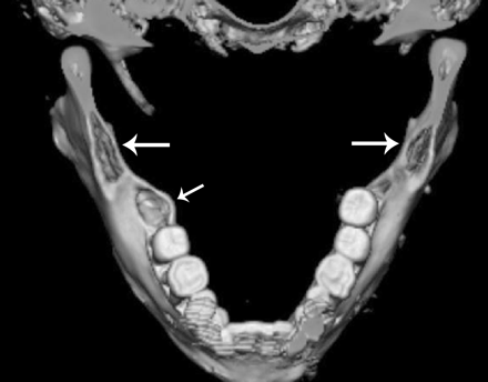 Fig. 10.