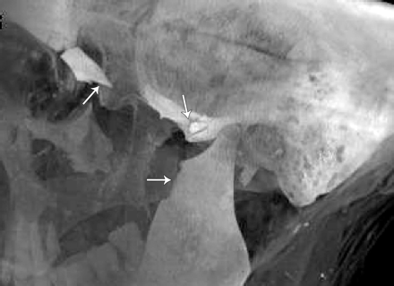 Fig. 11.