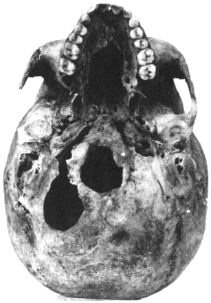 Fig. 13.