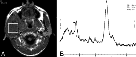 Fig 2.