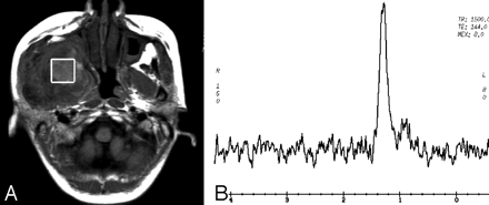Fig 3.