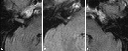 Fig 2.