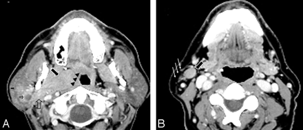 Fig 1.