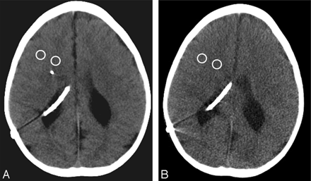 Fig 2.