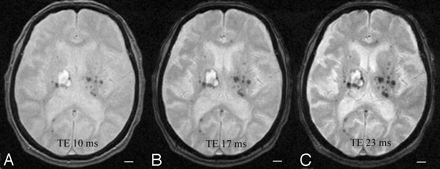   Fig 1. 