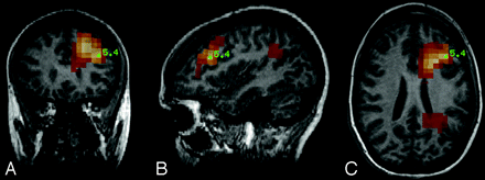 Fig 2.