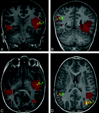 Fig 3.