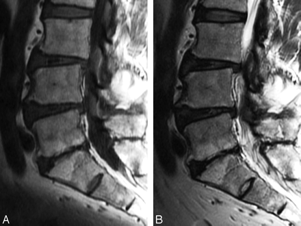Fig 2.