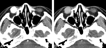 Fig 3.