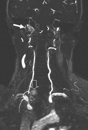 Fig 1.