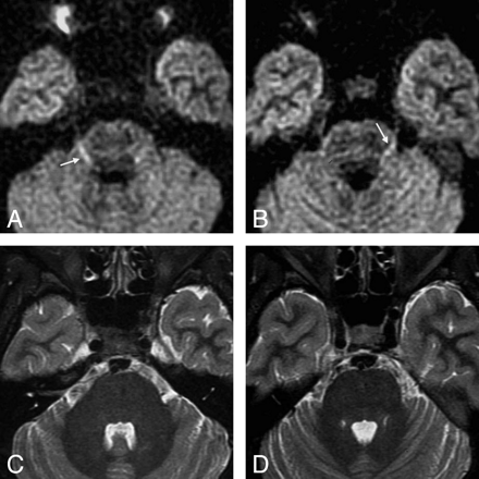 Fig 2.
