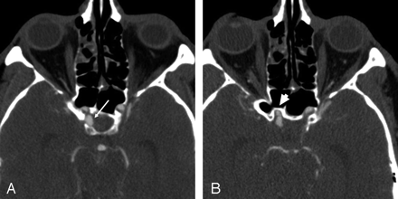 Fig 2.