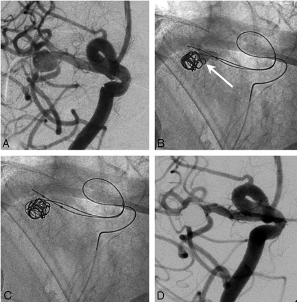Fig 4.
