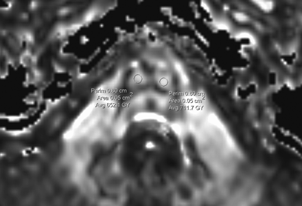 Fig 1.