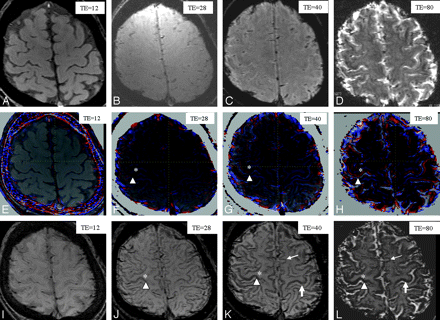 Fig 1.