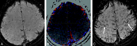 Fig 3.