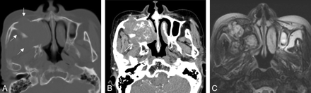 Fig 2.