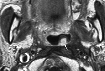 Fig 1.