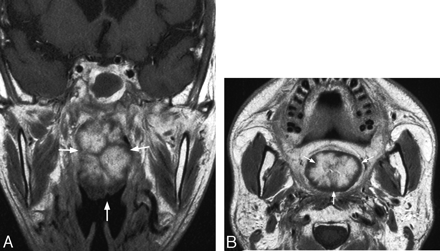 Fig 3.