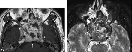 Fig 6.