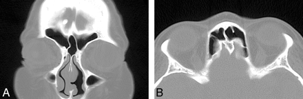 Fig 1.