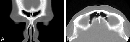 Fig 2.
