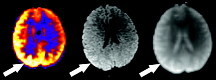 Fig 10.