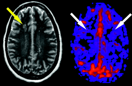 Fig 12.