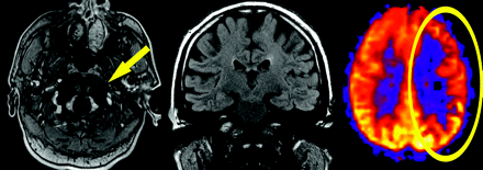Fig 2.