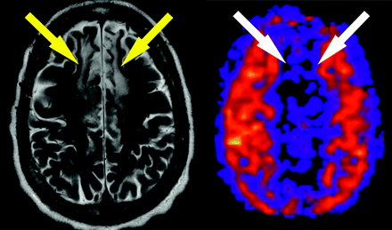 Fig 3.