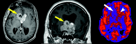 Fig 5.